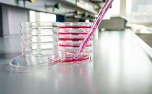 Albumin Promotion Albumin Promotion