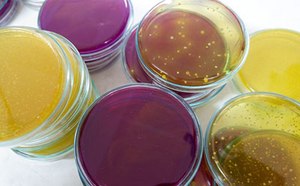 Cell Culture & Cell Culture Analysis Cell cultures in dishes