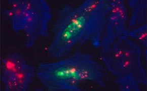 Transfected cells for protein expression and gene function studies Transfected cells for protein expression and gene function studies