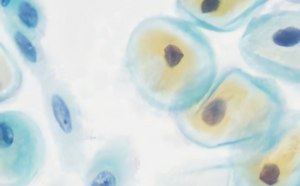 Cytology & Cytodiagnosis Cytology & Cytodiagnosis