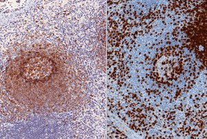 Immunohistochemistry Immunohistochemistry