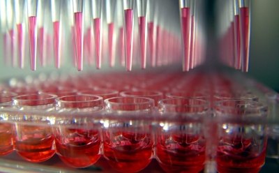 Functional genomics screening with arrayed or pooled libraries Functional genomics screening with arrayed or pooled libraries