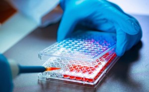 Tissue Engineering Tissue Engineering