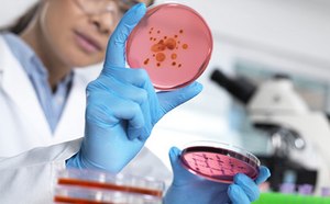 Microbial bioburden and water testing Female microbiologist wearing white lab coat, safety goggles and blue nitrile gloves examines a round petri dish with pink gel and red spots of bacteria.