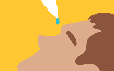 A person placing eye drops in their eye. A person placing eye drops in their eye.