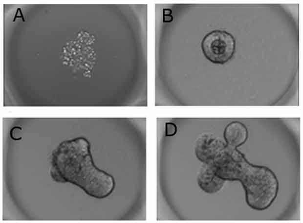 Brightfield images of mouse intestinal organoids Brightfield images of mouse intestinal organoids after seeding on Millicell<sup>®</sup> Microwell plates.