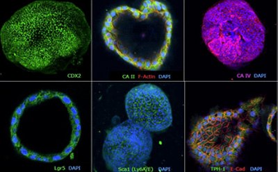 Lead Discovery Lead Discovery