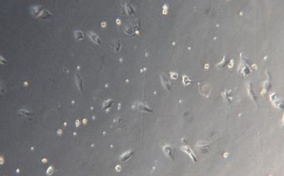 Kupffer C Microscopy image of Kupffer cells at 48 hours. Light grey square with small dark grey dots and small rectangles that indicate cells.