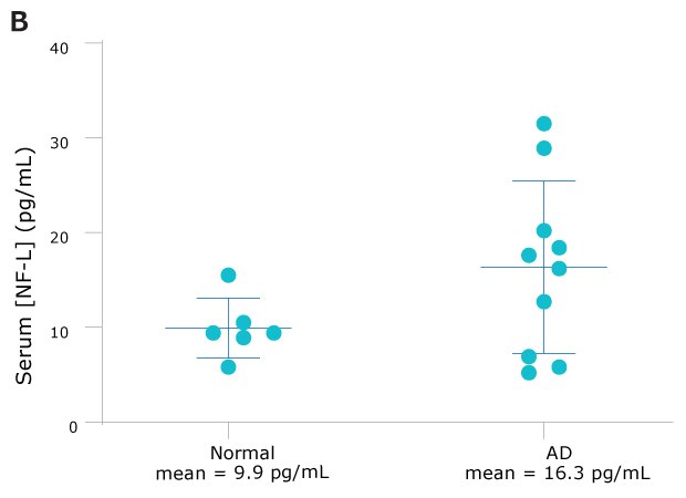 NF-L Serum Figure NF-L serum concentrations of AD (n=10) show nearly double that of normal (n=6) samples.
