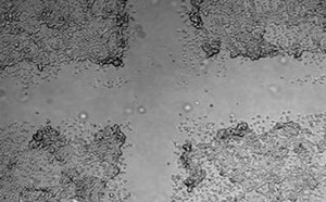 Cell Migration & Invasion Assays Cell Migration & Invasion Assays