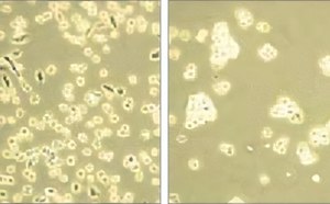 Cell dissociation This image presents a comparative microscopic analysis of cellular structures, showcasing two distinct photomicrographs. On the left, a dense aggregation of cells or microorganisms is observed, indicative of a possibly active growth environment. The right photomicrograph reveals a sparser distribution, potentially reflecting the impact of varying experimental conditions on cellular behavior or population density.