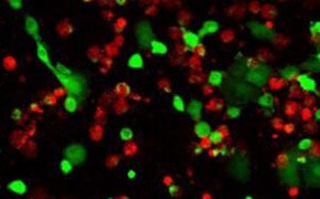 Live/dead cell double staining 생존/사멸 세포 이중 염색