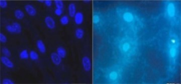 DNA detection agents such as DAPI or Hoechst reveal the presence of mycoplasma in contaminated cell cultures (right) DAPI 또는 Hoechst와 같은 일반적인 DNA 검출제는 형광 현미경을 사용하여 오염된 배양물에서 마이코플라스마의 존재를 나타냅니다.