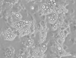 Visible lipid droplets 가시적인 지방구(lipid droplet)는 3T3-L1 분화 키트를 사용하여 분화 7일 후 지방전구세포의 분리를 확인합니다.