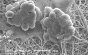 cells-grown-nanofiber-structural-insert-290x180.jpg cells-grown-nanofiber-structural-insert-290x180.jpg