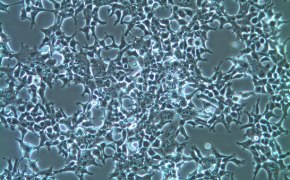 Microscopy image of HEK-293T cells. Rectangles with large spikes that emanate from the corners represent the cells cover the entire image.  Microscopy image of HEK-293T cells. Rectangles with large spikes that emanate from the corners represent the cells cover the entire image.