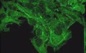 Focal Adhesion Contact Visualization Small dots cover the surface of the cells, so no dot is completely visible. The cells cover the top of the image and expands into the bottom middle of the image.