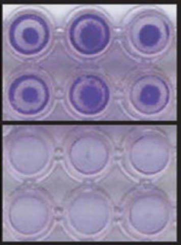 Invasion by HT-1080 cells is determined by 96-well Cell Invasion Assay. NIH3T3 cells were used as a non-invasive control 96웰 세포 침습 분석법으로 측정하는 HT-1080 세포 침범. 침습한 세포는 NIH3T3 음성 대조군과 함께 크리스탈 바이올렛 염색으로 가시화되었습니다.