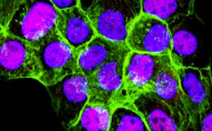 Fluorescent staining of cultured mammalian cells Fluorescent staining of cultured mammalian cells