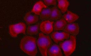 UFH-001 Human Triple Negative Breast Cancer Cells Fluorescent staining of UFH-001 Human Breast Cancer Cells