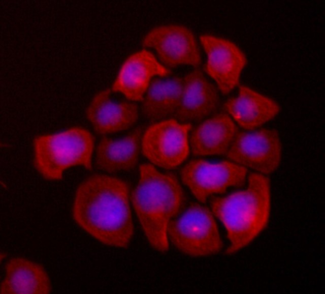 UFH-001 Human Triple Negative Breast Cancer cells, SCC210 UFH-001 인간 유방암 세포의 형광 염색