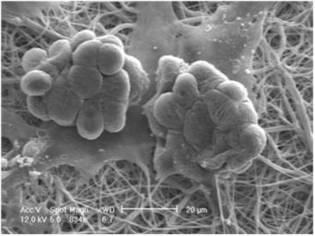 Cells grown on a Nanofiber structural insert Scanning electron microscope image showing two clusters of round, bulbous structures resembling microbial colonies, adhered to a fibrous matrix. The image is in black and white, emphasizing the texture and detail of the microorganisms and fibers, with a scale bar indicating a measurement of 20 micrometers.