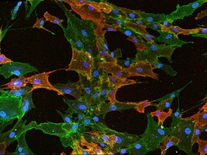 Fluorescent ICC staining of mesenchymal stem cells Fluorescent ICC staining of mesenchymal stem cells