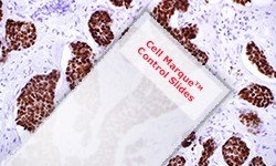 Cell Marque™ control slides for IHC staining IHC staining micrograph from a Cell Marque™ control slide