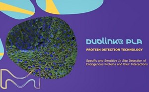 Duolink<sup>®</sup> Proximity Ligation Assay Duolink<sup>®</sup> Proximity Ligation Assay