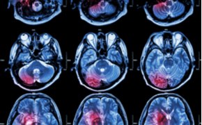 Metabolic Imaging with Hyperpolarization Metabolic Imaging with Hyperpolarization