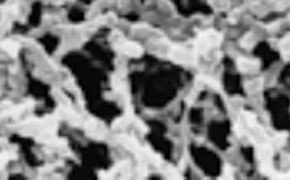 Filter Membranes Filter Membranes
