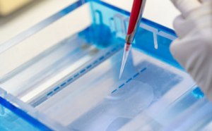 Nucleic Acid Electrophoresis & Hybridization Nucleic Acid Electrophoresis & Hybridization