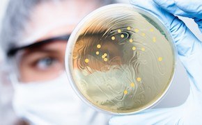 <p>Strategies to Address Bioburden Control in Downstream Processing</p>
 gloved hand holding up a petri dish