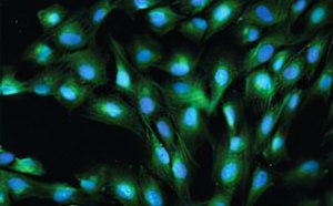 Secondary Antibodies - Immunofluorescence Equine exuberant granulation (proud flesh) tissue stained using Anti-von Wille
