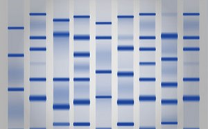 Protein Electrophoresis & Western Blotting Protein Electrophoresis & Western Blotting