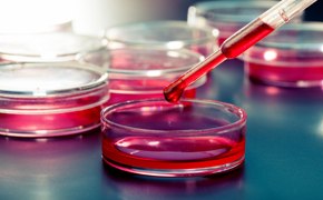 Tissue Dissocation A close-up view shows several petri dishes filled with a pink liquid medium. In the foreground, a pipette is dispensing a red fluid into one of the petri dishes. The background features additional petri dishes and the environment suggests a sterile, controlled setting typical for biological research.