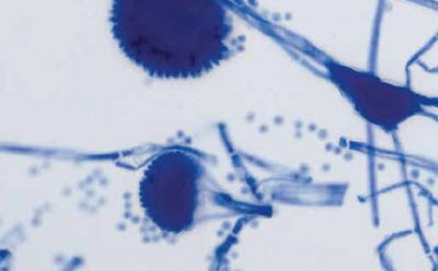 Culture, smear, Lactophenol blue staining Bacteriology staining micrograph of smear culture using Lactophenol blue