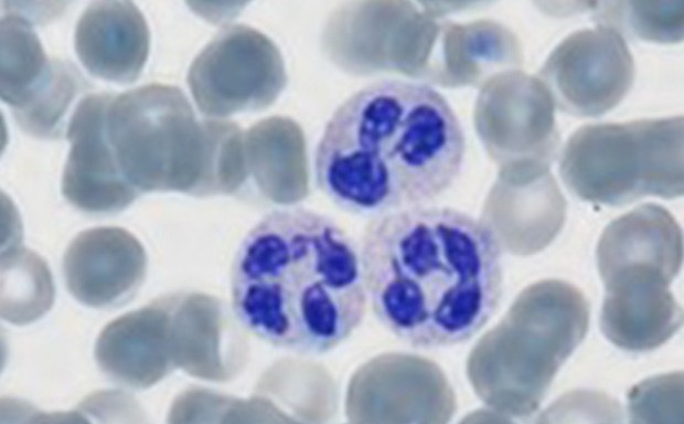 HARLECO® Polychromatic stain used for staining of blood parasites The image is a microscopic view of biological cells, with three central cells featuring prominent dark blue nuclei and surrounded by lighter, more uniform cells against a white background.