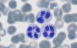 혈액 염색제 혈액 염색제