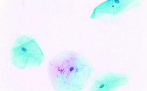 세포 염색제 세포 염색제