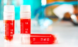 Cell Lines for Viral Research Cell Lines for Viral Research
