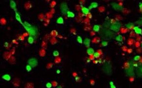 Live/dead cell double staining Protein mass spectrometry tools