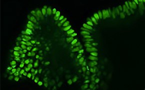 Organoids Microscopic image of fluorescently-stained organoids