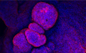 Microscopic image of fluorescently-stained human colon organoids
