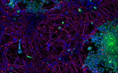 StressMarq Active Human Recombinant Alpha Synuclein Pre-Formed Fibrils StressMarq Active Human Recombinant Alpha Synuclein Pre-Formed Fibrils (Type 1), 100 µg