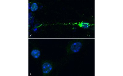 StressMarq Active Mouse Recombinant Alpha Synuclein Pre-formed Fibrils StressMarq Active Mouse Recombinant Alpha Synuclein Pre-formed Fibrils (Type 1), 100 µg