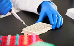 Custom MILLIPLEX® Multiplex Assays & ELISAs Custom MILLIPLEX® Multiplex Assays & ELISAs