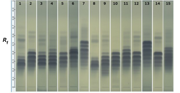 HPTLC bands of different oils. HPTLC bands of blue color in varying intensities obtained for 15 different oils on a Silica Gel 60 RP18 F254 plates kept next to each other, labeled 1 to 15 from left to right.