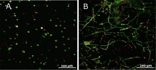 3T3 fibroblasts in TrueGel3D™ hydrogels made of FAST-PVA polymer modified with TrueGel3D™ RGD integrin adhesion peptide and crosslinked with either PEG non cell-degradable (left) or CD cell-degradable crosslinker (right). Pictures show collapsed stacks of confocal frames representing a height of 300 µm of the gel. Red: nuclei; green: actin cytoskeleton. Scale bar: 200 µm 3T3 fibroblasts in TrueGel3D™ hydrogels