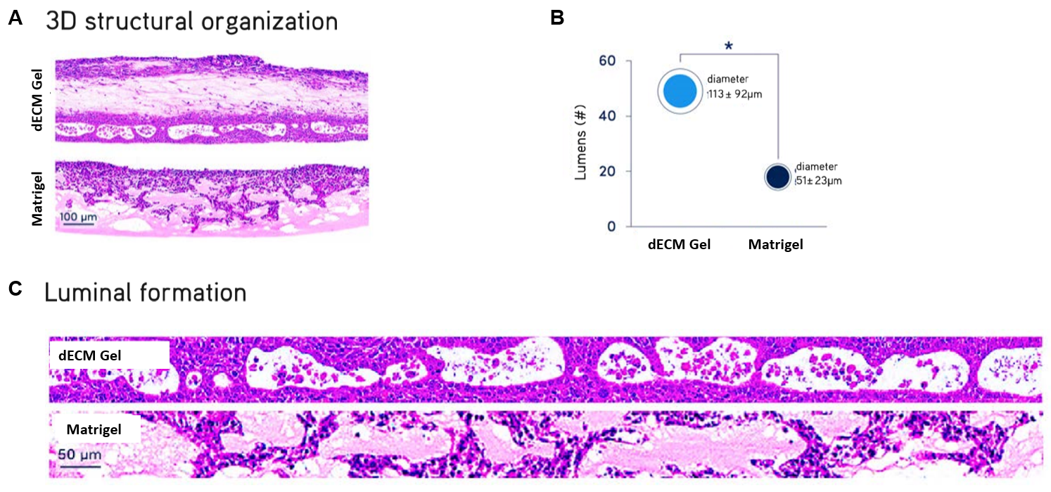 Air liquid interface (ALI) cultures of primary normal human bronchial epithelial (NHBE) cells after 21 days. NHBE cells cultured in Lung dECM Hydrogels formed more organized and complex stratified luminal structures recapitulating the cellular architecture of the human airway, with significantly larger average diameter compared to Matrigel<sup>®</sup> matrix. ALI cultures of primary NHBE cells.